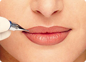 Lippen